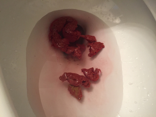 Who put poop in my trash can?